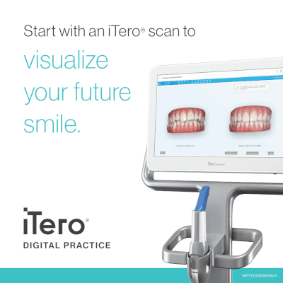 iTero Digital Scanner 3D Digital Orthodontic Impressions